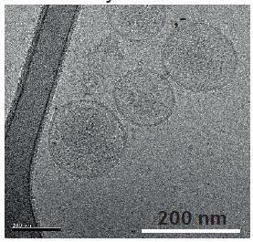 exosomes-200nm