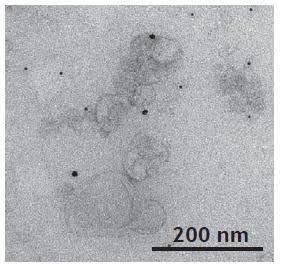exosomes-another-sample-200nm