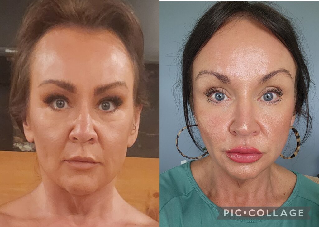 Image #1 from Miranda Bryant